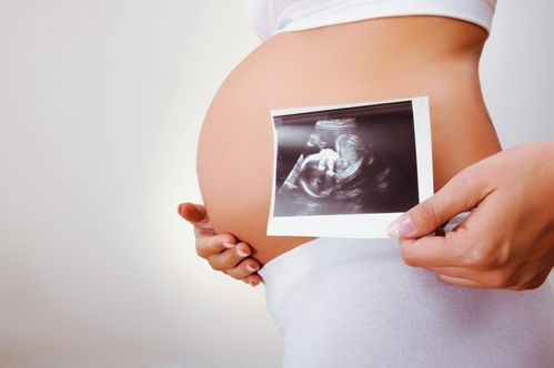 海南孕妇孕期可以做亲子鉴定吗？